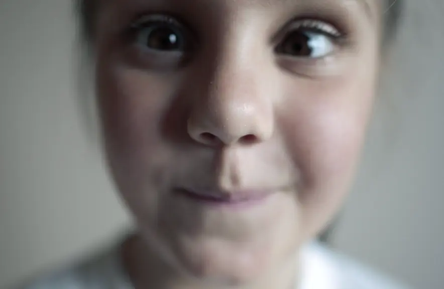 Child with Squint